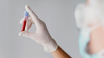 Исследование показало: остеопороз на ранней стадии выявляют общим анализом крови