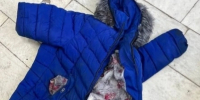 В Самарской области установили личность погибшей женщины в горбольнице - Комсомольская Правда Самара