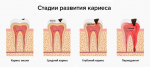 4 июня – Всемирный день борьбы с кариесом (Международный день был учрежден по инициативе стоматологов с 2013 года